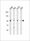 BRAF Antibody (T400)