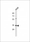 CASP5 Antibody (Center)