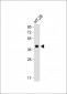 OR2AT4 Antibody (C-term)