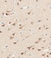 AP1M1 Antibody (Center)