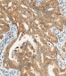 CTAG1A Antibody (N-term)