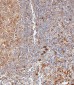 HLA-DPB1 Antibody (Center)