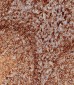 HLA-DPB1 Antibody (Center)