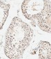UBE4B Antibody (N-term)