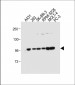 ADAMTS17 Antibody (Center)