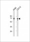 SQSTM1 (p62) Antibody (C-term)