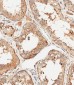 MUT Antibody (N-Term)