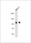 INPP4B Antibody (Center)
