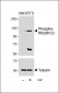 Phospho-RB(S612) Antibody