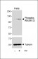 Phospho-RB(S612) Antibody