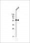 CALR Antibody (Center)