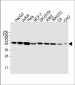 CALR Antibody (Center)