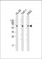 CARD9 Antibody (N-term)