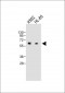 CARD9 Antibody (N-term)