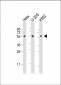 AIRE Antibody (Center)