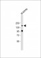 COL4A2 Antibody (N-term)