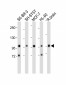 PCDH20 Antibody (Center)