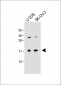 FGF16 Antibody (N-term)