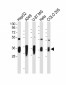 AKR1C2 Antibody (C-term)