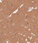 APG8b(MAP1LC3B) Antibody (N-term T29)