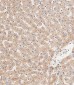 APG8b(MAP1LC3B) Antibody (N-term T29)