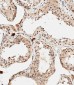 PDCD4 Antibody (Center)