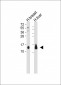 CXCL2 Antibody (C-term)