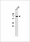 GPC4 Antibody (Center)