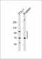 CD36 Antibody (Center)