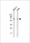 S6K (RPS6KB1) Antibody (S424)