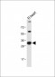 CASP3(Asp175) Antibody