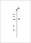 MEIS2 Antibody (Center D269)