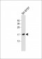 FGF1 Antibody (N-term)