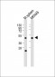 CTSE Antibody (Center)