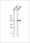 CTSE Antibody (Center)
