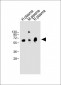 TPA Antibody (Center)