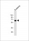 TPA Antibody (Center)