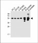 ACPP Antibody (C-term)