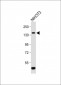 ROR1 Antibody (N-term)