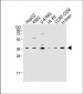 MPZ Antibody (C-term)