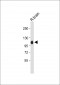 MAG Antibody (Center)