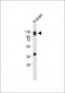 MAG Antibody (Center)