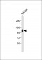 MAG Antibody (Center)