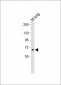 ALOX12 Antibody (C-term)