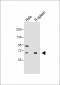 ALOX12 Antibody (C-term)