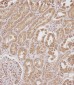 SERPINA6 Antibody (Center)