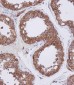 HDAC6 Antibody (C-term)