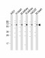 OTOP1 Antibody (Center)