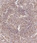 CD163L1 Antibody (C-term)