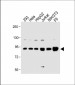 MOV10 Antibody (N-term)